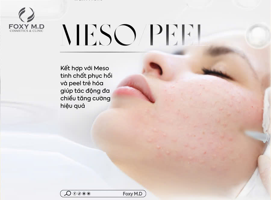 meso peel